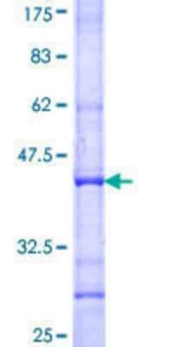 Novus Biologicals Recombinant Human OSR1 GST (N-Term) Protein 10 &mu;g | Buy Online | Novus Biologicals&trade; | Fisher Scientific