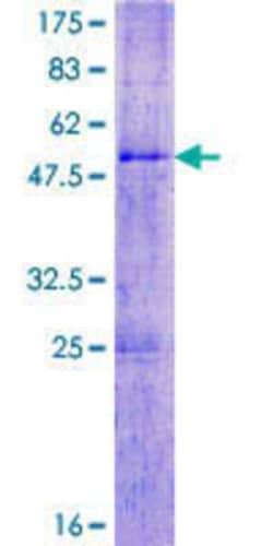 Novus Biologicals Recombinant Human SPATA3 GST (N-Term) Protein 2 &mu;g | Buy Online | Novus Biologicals&trade; | Fisher Scientific
