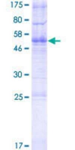 Novus Biologicals Recombinant Human TMEM178 GST (N-Term) Protein 2 &mu;g | Buy Online | Novus Biologicals&trade; | Fisher Scientific