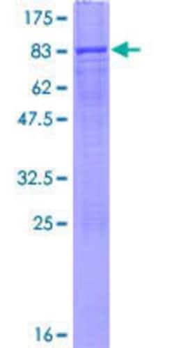 R&D Systems&trade;&nbsp;Recombinant Human MDH1B GST (N-Term) Protein