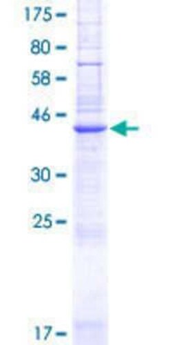 Novus Biologicals Recombinant Human PQLC3 GST (N-Term) Protein 2 &mu;g | Buy Online | Novus Biologicals&trade; | Fisher Scientific