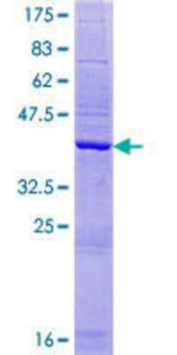 Novus Biologicals Recombinant Human AHSA2 GST (N-Term) Protein 10 &mu;g | Buy Online | Novus Biologicals&trade; | Fisher Scientific