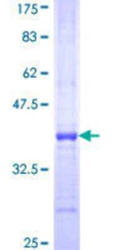 Novus Biologicals Recombinant Human FBXO36 GST (N-Term) Protein 10 &mu;g | Buy Online | Novus Biologicals&trade; | Fisher Scientific