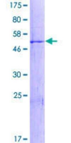 Novus Biologicals Recombinant Human CCDC148 GST (N-Term) Protein 2 &mu;g | Buy Online | Novus Biologicals&trade; | Fisher Scientific