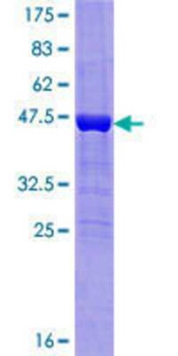 Novus Biologicals Recombinant Human CHCHD4 GST (N-Term) Protein 10 &mu;g | Buy Online | Novus Biologicals&trade; | Fisher Scientific