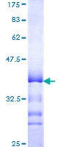 Novus Biologicals Recombinant Human GPR175 GST (N-Term) Protein 10 &mu;g | Buy Online | Novus Biologicals&trade; | Fisher Scientific