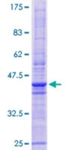 Novus Biologicals Recombinant Human TMEM42 GST (N-Term) Protein 10 &mu;g | Buy Online | Novus Biologicals&trade; | Fisher Scientific