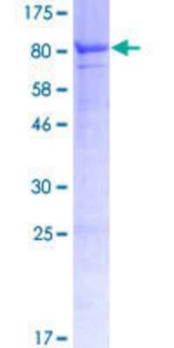 Novus Biologicals Recombinant Human GRK7 GST (N-Term) Protein 10 &mu;g | Buy Online | Novus Biologicals&trade; | Fisher Scientific