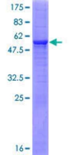 Novus Biologicals&trade;&nbsp;Recombinant Human Methyltransferase like 6 GST (N-Term) Protein