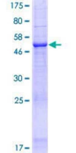 Novus Biologicals Recombinant Human IQCF1 GST (N-Term) Protein 10 &mu;g | Buy Online | Novus Biologicals&trade; | Fisher Scientific