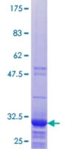 Novus Biologicals Recombinant Human RPL32P3 GST (N-Term) Protein 25 &mu;g | Buy Online | Novus Biologicals&trade; | Fisher Scientific