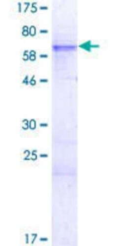 Novus Biologicals Recombinant Human Rex-1/ZFP42 GST (N-Term) Protein 10 &mu;g | Buy Online | Novus Biologicals&trade; | Fisher Scientific