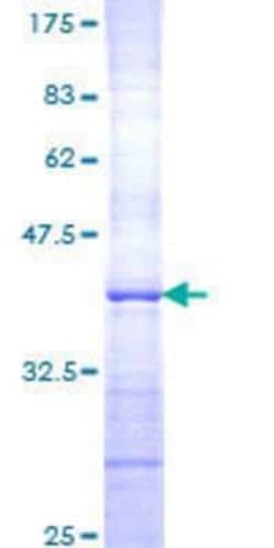 Novus Biologicals Recombinant Human SPATA4 GST (N-Term) Protein 10 &mu;g | Buy Online | Novus Biologicals&trade; | Fisher Scientific
