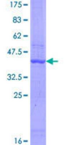 Novus Biologicals Recombinant Human AASDH GST (N-Term) Protein 25 &mu;g | Buy Online | Novus Biologicals&trade; | Fisher Scientific