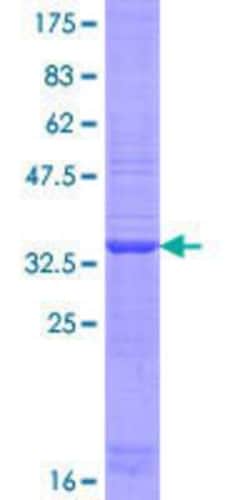 Novus Biologicals Recombinant Human OTOP1 GST (N-Term) Protein 10 &mu;g | Buy Online | Novus Biologicals&trade; | Fisher Scientific