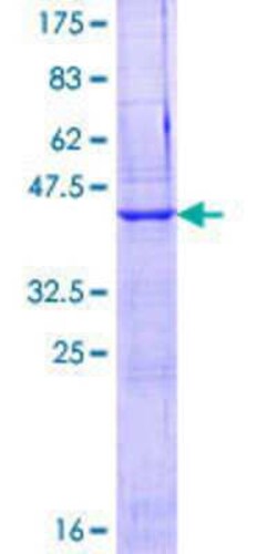 Novus Biologicals Recombinant Human EGFLAM GST (N-Term) Protein 10 &mu;g | Buy Online | Novus Biologicals&trade; | Fisher Scientific