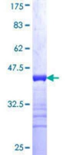 Novus Biologicals Recombinant Human JMY GST (N-Term) Protein 10 &mu;g | Buy Online | Novus Biologicals&trade; | Fisher Scientific
