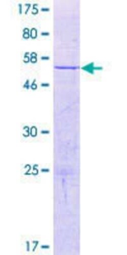 Novus Biologicals Recombinant Human CCDC127 GST (N-Term) Protein 2 &mu;g | Buy Online | Novus Biologicals&trade; | Fisher Scientific