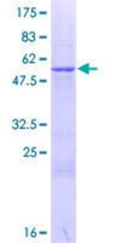 Novus Biologicals Recombinant Human GRPEL2 GST (N-Term) Protein 25 &mu;g | Buy Online | Novus Biologicals&trade; | Fisher Scientific