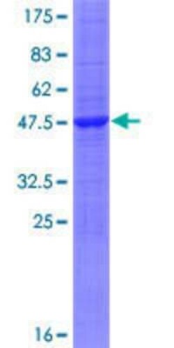Novus Biologicals Recombinant Human HINT3 GST (N-Term) Protein 25 &mu;g | Buy Online | Novus Biologicals&trade; | Fisher Scientific