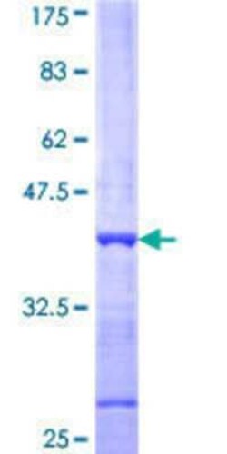 Novus Biologicals Recombinant Human PACRG GST (N-Term) Protein 25 &mu;g | Buy Online | Novus Biologicals&trade; | Fisher Scientific