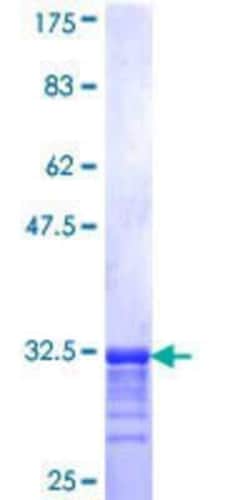 Novus Biologicals Recombinant Human EMID2 GST (N-Term) Protein 25 &mu;g | Buy Online | Novus Biologicals&trade; | Fisher Scientific