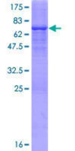 Novus Biologicals&trade;&nbsp;Recombinant Human ADHFE1 GST (N-Term) Protein