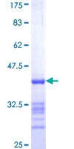 Novus Biologicals Recombinant Human ADHFE1 GST (N-Term) Protein 10 &mu;g | Buy Online | Novus Biologicals&trade; | Fisher Scientific