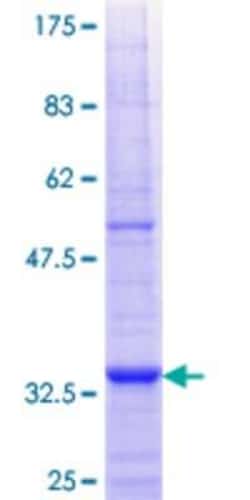 Novus Biologicals Recombinant Human AGPAT6 GST (N-Term) Protein 25 &mu;g | Buy Online | Novus Biologicals&trade; | Fisher Scientific