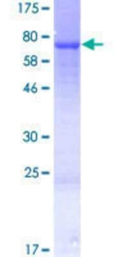Novus Biologicals Recombinant Human LETM2 GST (N-Term) Protein 25 &mu;g | Buy Online | Novus Biologicals&trade; | Fisher Scientific
