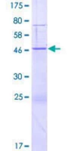 Novus Biologicals Recombinant Human HGSNAT GST (N-Term) Protein 2 &mu;g | Buy Online | Novus Biologicals&trade; | Fisher Scientific
