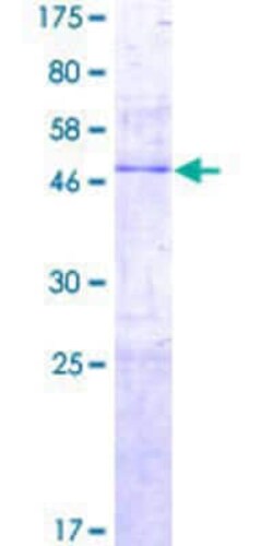 Novus Biologicals Recombinant Human PTRH1 GST (N-Term) Protein 2 &mu;g | Buy Online | Novus Biologicals&trade; | Fisher Scientific