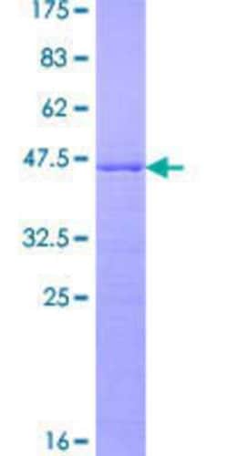 Novus Biologicals Recombinant Human RPP25L GST (N-Term) Protein 25 &mu;g | Buy Online | Novus Biologicals&trade; | Fisher Scientific
