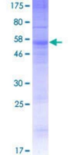 Novus Biologicals Recombinant Human OR13C4 GST (N-Term) Protein 10 &mu;g | Buy Online | Novus Biologicals&trade; | Fisher Scientific