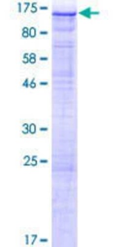 Novus Biologicals Recombinant Human PASD1 GST (N-Term) Protein 2 &mu;g | Buy Online | Novus Biologicals&trade; | Fisher Scientific