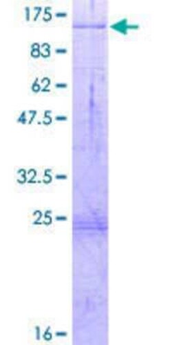 Novus Biologicals Recombinant Human HDX GST (N-Term) Protein 2 &mu;g | Buy Online | Novus Biologicals&trade; | Fisher Scientific