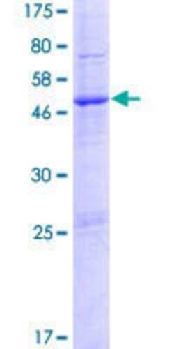 Novus Biologicals Recombinant Human PTCHD1 GST (N-Term) Protein 25 &mu;g | Buy Online | Novus Biologicals&trade; | Fisher Scientific