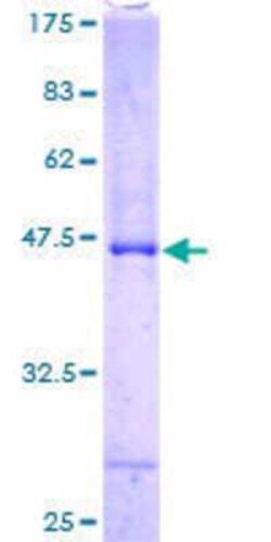 Novus Biologicals Recombinant Human ASB6 GST (N-Term) Protein 25 &mu;g | Buy Online | Novus Biologicals&trade; | Fisher Scientific