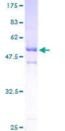 Novus Biologicals Recombinant Human ASB9 GST (N-Term) Protein 10 &mu;g | Buy Online | Novus Biologicals&trade; | Fisher Scientific