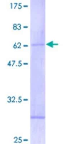 Novus Biologicals Recombinant Human RNF32 GST (N-Term) Protein 10 &mu;g | Buy Online | Novus Biologicals&trade; | Fisher Scientific