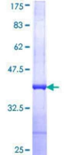 Novus Biologicals Recombinant Human RNF32 GST (N-Term) Protein 10 &mu;g | Buy Online | Novus Biologicals&trade; | Fisher Scientific