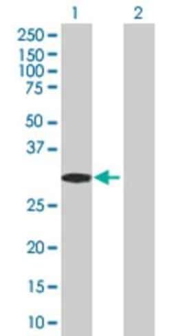 Novus Biologicals&trade;&nbsp;RNF32 293T Cell Transient Overexpression Lysate