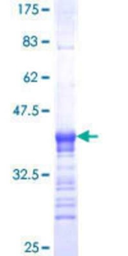 Novus Biologicals Recombinant Human GATA-5 GST (N-Term) Protein 10 &mu;g | Buy Online | Novus Biologicals&trade; | Fisher Scientific