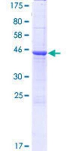 Novus Biologicals Recombinant Human Cerebellin-4 GST (N-Term) Protein 25 &mu;g | Buy Online | Novus Biologicals&trade; | Fisher Scientific