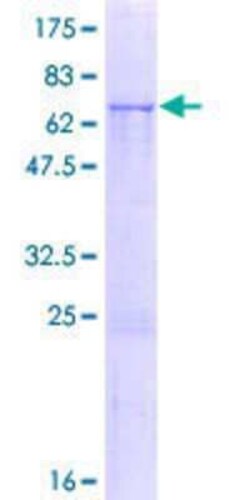 Novus Biologicals Recombinant Human PABPC5 GST (N-Term) Protein 25 &mu;g | Buy Online | Novus Biologicals&trade; | Fisher Scientific