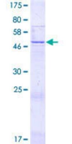 Novus Biologicals™ Recombinant Human R3HDML GST (N-Term) Protein
