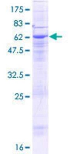 Novus Biologicals Recombinant Human SAMD8 GST (N-Term) Protein 10 &mu;g | Buy Online | Novus Biologicals&trade; | Fisher Scientific