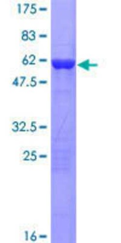 Novus Biologicals&trade;&nbsp;Recombinant Human FRMPD2 GST (N-Term) Protein