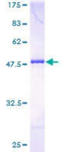 Novus Biologicals Recombinant Human DYDC1 GST (N-Term) Protein 25 &mu;g | Buy Online | Novus Biologicals&trade; | Fisher Scientific