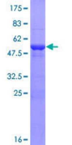Novus Biologicals Recombinant Human HECTD2 GST (N-Term) Protein 25 &mu;g | Buy Online | Novus Biologicals&trade; | Fisher Scientific